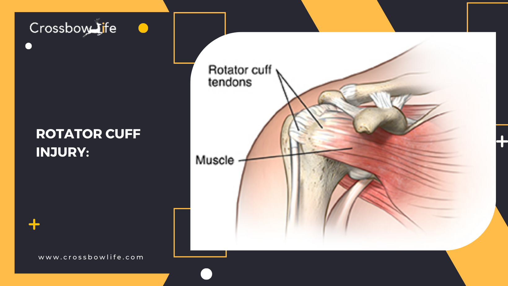 What are the injuries that archer’s usually faced? How to treat them?