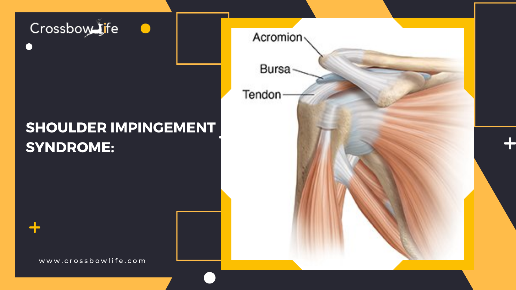 What are the injuries that archer’s usually faced? How to treat them?